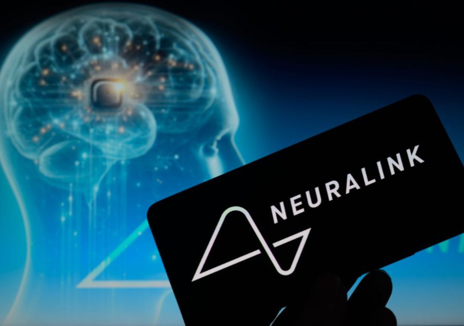 მასკის Neuralink-ი ტვინის იმპლანტის მეორე პაციენტისთვის გადასანერგად ემზადება