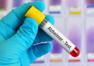 FDA-მა ალცჰაიმერის დიაგნოსტიკისთვის სისხლის პირველი ტესტი დაამტკიცა